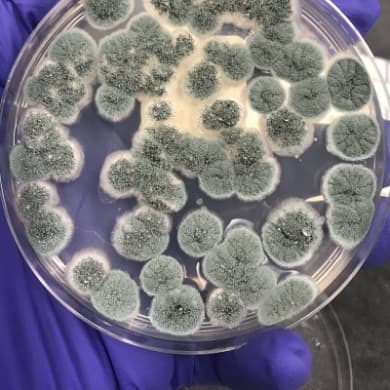 Colony morphology — microbiology lab